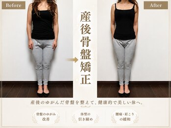 練馬アカデミア美容整体院/産後骨盤矯正 痩身 マタニティ
