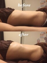 マージェ(magie)/腸セラピー