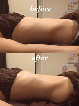 マージェ(magie)/腸セラピー