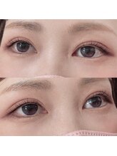 リボーテ(Reboaute)/アップフォースリフト