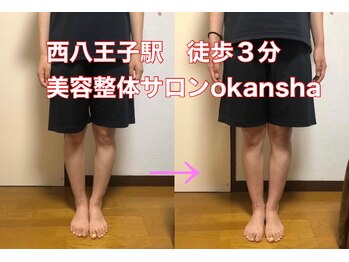 美容整体サロン オオカンシャ(okansha)/O脚Before→after1