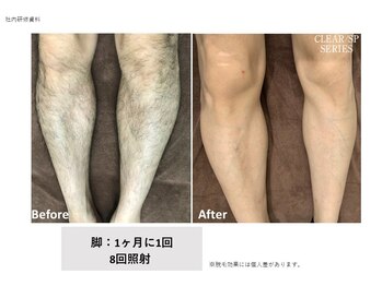 ルミナス 八尾店(Luminous)/メンズ両足8回目