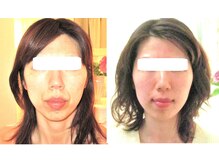 サロンドエステケイワイ(de KY)/フェイシャル☆小顔・タルミ改善