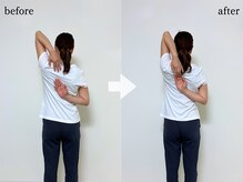 エーアール(AR)/【Before/After】3回目