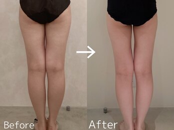 カレンジェビューティー(CarengeBeauty)/スリムカッター下半身