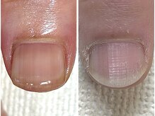 カランコエ(Kalanchoe)/地爪育成