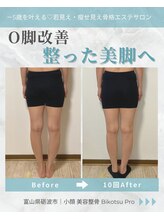 ビコツプロ(Bikotsu Pro)/O脚改善！整った美脚へ