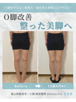 ビコツプロ(Bikotsu Pro)/O脚改善！整った美脚へ