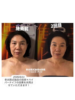 幸永院 川口店の写真/短時間一度でも驚きの激変！たるみ,むくみ,歪み,エラ,ほうれい線,面長,丸顔改善♪サイズ&美肌変化に驚愕！