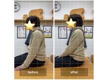 ナオル整体 飯田橋院(NAORU整体)/Before After/飯田橋/整体・矯正