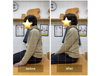 ナオル整体 飯田橋院(NAORU整体)/Before After/飯田橋/整体・矯正