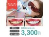 《都度払い》1回で即実感!!かなり白くなる!!セルフホワイトニング ￥3,300