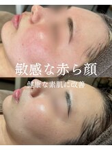 インテリウス(INteRius.)/スキンケアの相乗効果