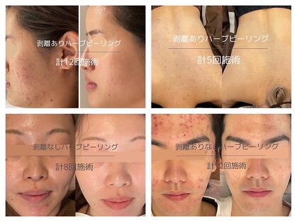 ライフ美容整体院 恵比寿(Life美容整体院)の写真