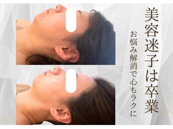 ソナ 大和西大寺院(SONA)/顎ヒアル、ちょっと待って