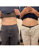 ナオ接骨院(NAO接骨院)/Before／After