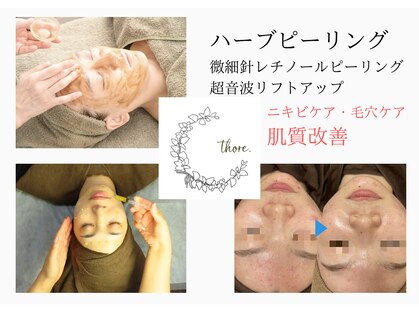 トレ(thore.)の写真