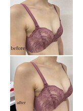 イリス 神田(iris)/バストアップ♪♪