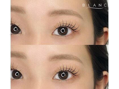 アイラッシュサロン ブラン Lty草津店(Eyelash Salon Blanc)の写真