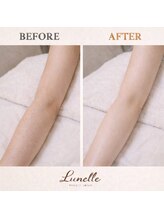 ルネル(Lunelle)/素肌レベル上げ★