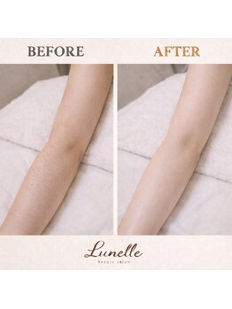 ルネル(Lunelle)/素肌レベル上げ★