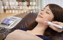 ベレッツァ(Bellezza)