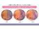 もみほぐし～ぷカンバラ(KAMBARA)の写真/毛穴レス肌へ！独自手技で黒ずみ対策◎根こそぎお掃除する結果だしエステ体験♪
