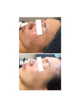 オアジスパ(Oasi Spa)/