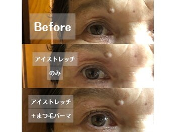 イーストアッカ アイラッシュ(East AkkA eyelash)/ダブルアイリフト