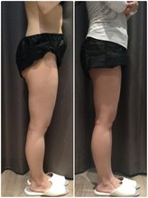 アイスタイル(i-style)/脂肪冷却/痩身ダイエット/泉大津