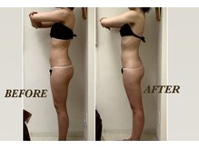 プリマ(Prima)/BEFORE&AFTER