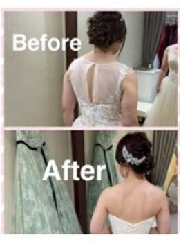 エステティックサロン クレアの写真/【エリア初導入★最新痩身ラジオ波ウィンバック】ドレスを着ると目立つ二の腕・背中も見違える程スッキリ♪