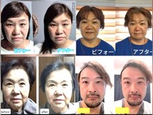 整体院 てんとてん 吉祥寺/小顔矯正の変化