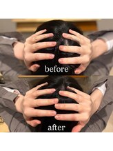 モモ 札幌(MOMO.)/固くなった頭皮をほぐすと