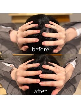 モモ 札幌(MOMO.)/固くなった頭皮をほぐすと