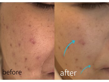 ルーム701(room701)/毛穴 たるみ シワ シミ