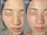 【ツヤ肌メイクノリUP】産毛・角質オフ全顔フェイスWAX＋保湿鎮静パック