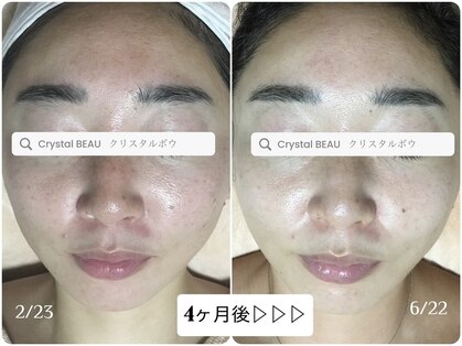 クリスタルボウ(Crystal BEAU)の写真