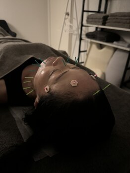 ラフテル鍼灸整骨院/西大橋駅徒歩3分の美容鍼サロン