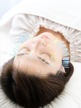 高宮レディース鍼灸整骨院の写真/【小顔矯正60分¥5,980】二重顎やたるみ・しわ改善！鍼による小顔矯正で気になるお顔周りのもたつき解消！