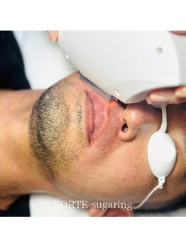 ソルテシュガーリング(SORTE sugaring)/メンズ脱毛