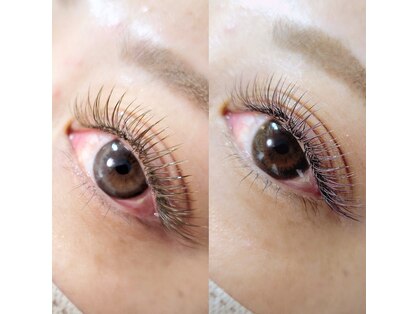 サンシェール(sincere.R)の写真