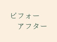アンレミューラボ(Un Lemieux Labo)/【ビフォーアフター】