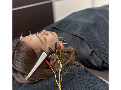 ケアフォー 西小山(Carefor)の写真