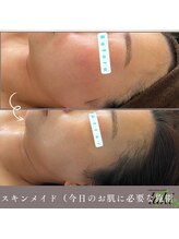 リラクゼーションサロン ラキ(laki)/トロイアルケ、スキンメイド