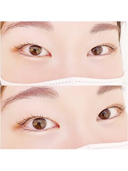 イーエヌトリップ(en.trip)/ケラチンラッシュリフト