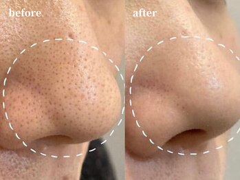 クレールアンジュ(ClairAnge)/毛穴が気になる方