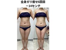 ステラ(Stella)/全身ガリ痩せ6回目14センチ