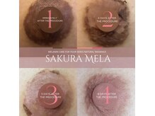 マドモアゼル 麻布十番の雰囲気（毛穴ケア/麻布十番/韓国美容/肌管理/脱毛/ララピール/インディバ）