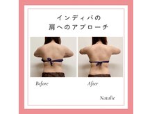 ナタリー(Natalie)/つらい肩こりに